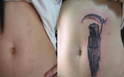 南京哪家醫(yī)院做隆鼻好？選擇哪家醫(yī)院效果最好，價(jià)格又合理又安全