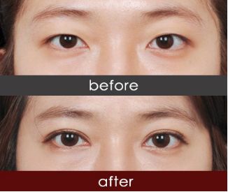 四川美容整形機構哪家好？全方位評比四川最佳美容整形機構排行榜