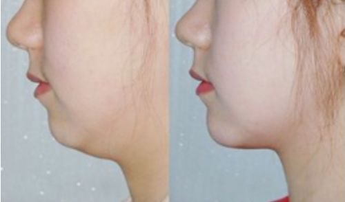 山東臨沂整容醫(yī)院排行榜及綜合評(píng)價(jià)：哪家好？