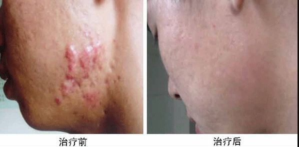 合肥哪家整容醫(yī)院雙眼皮做得好？專業(yè)整形外科專家推薦