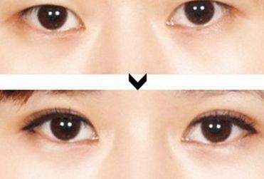 寧夏整形醫(yī)院哪家好？綜合評(píng)測(cè)，推薦您最滿意的整形醫(yī)院