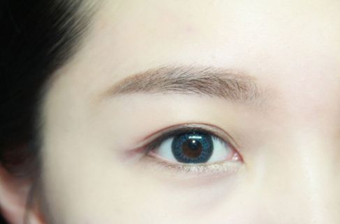 寧波哪家醫(yī)院割雙眼皮效果好？