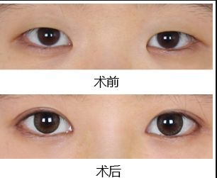 鄭州去黑點(diǎn)哪家醫(yī)院好？揭秘最受歡迎的黑點(diǎn)去除醫(yī)院