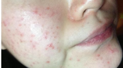 北京豐臺(tái)右安門醫(yī)院醫(yī)生好不好？服務(wù)口碑如何？