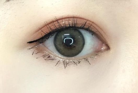 如何評(píng)價(jià)深圳和協(xié)醫(yī)院的脂肪填充手術(shù)？費(fèi)用是多少？醫(yī)生資質(zhì)如何？