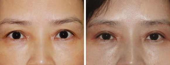 上海激光美容醫(yī)院排名及熱門選擇，哪家好？