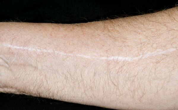 2023義烏骨性材料注射隆鼻權威專家排名前十位(徐學忠、董孟松，、汪波宇沖進前三名！)