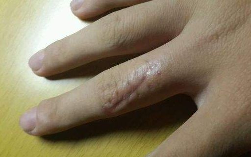 上海哪家醫(yī)院做肋骨鼻子整形手術(shù)好？