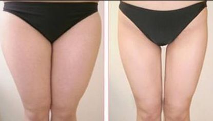 如何評價廣州珈禾整形醫(yī)院的口碑和質(zhì)量？