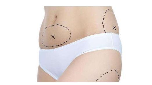 上海哪家醫(yī)院的祛眼袋手術(shù)效果最好？讓您的眼睛重獲明亮與青春