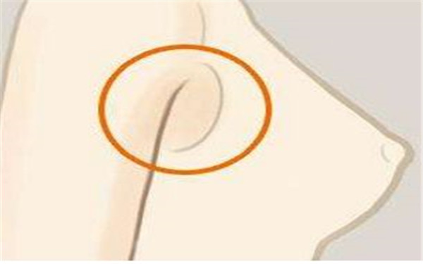 范巨峰醫(yī)生個人故事：驚艷雙眼皮案例與專業(yè)實力！