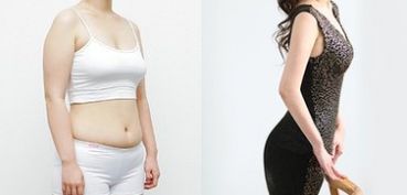 成都做雙眼皮，哪家醫(yī)院專業(yè)可靠？