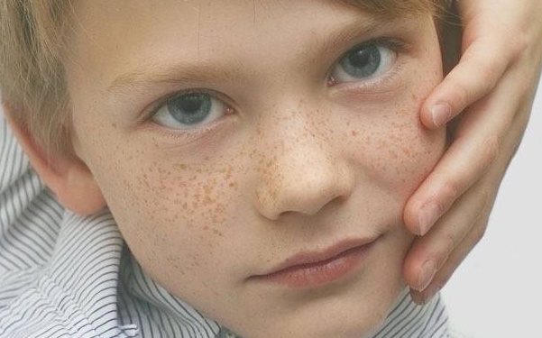 2023上海下眼皮皺紋注射玻尿酸強(qiáng)榜前十位的專家(余文靜、熊錦、韋敏當(dāng)?shù)卣淹扑])