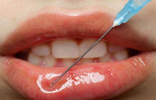 南京鼻梁塌醫(yī)院哪家好？南京鼻梁塌矯正醫(yī)院排名及選擇技巧分析