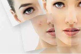 上海哪家醫(yī)院祛太田痣效果最佳？