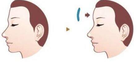 廣州整容行業(yè)的5位醫(yī)生，為你推薦熟悉整圈內(nèi)的大咖！