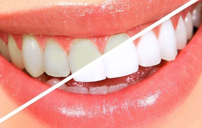 天津哪家醫(yī)院看鼻腔好？癥狀嚴(yán)重時(shí)如何尋找專業(yè)醫(yī)院治療？