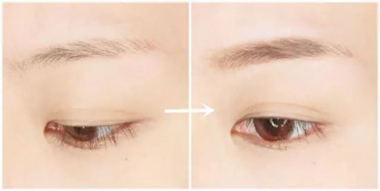 2023大連注射玻尿酸正規(guī)醫(yī)生榜單TOP10強(qiáng)(盧新蕾、張東、劉延偉名單_口碑分享)