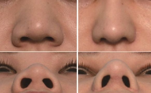 湖州市哪家醫(yī)院去疤痕好？專(zhuān)家推薦疤痕修復(fù)技術(shù)排行榜！