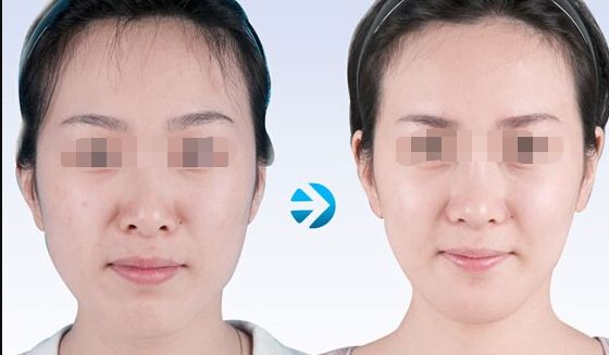 【2023北京哪家醫(yī)院做皮秒好？皮秒技術(shù)排行榜推薦】