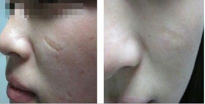 湖北棗陽(yáng)整形醫(yī)院哪家最值得信賴？