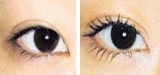 錦州雙眼皮手術(shù)有哪些好的醫(yī)院推薦？