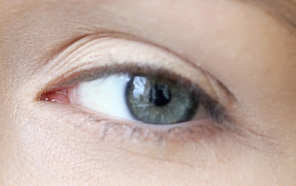 安醫(yī)大一附院整形科張林門(mén)診時(shí)間及雙眼皮案例分享