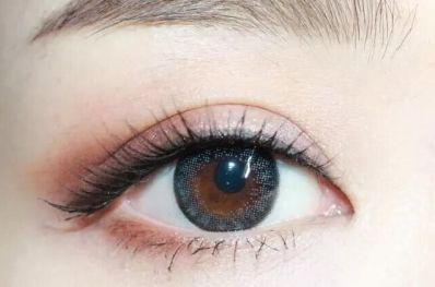 如何選擇德陽(yáng)切開雙眼皮專家？評(píng)估這些因素找到最好的醫(yī)院！