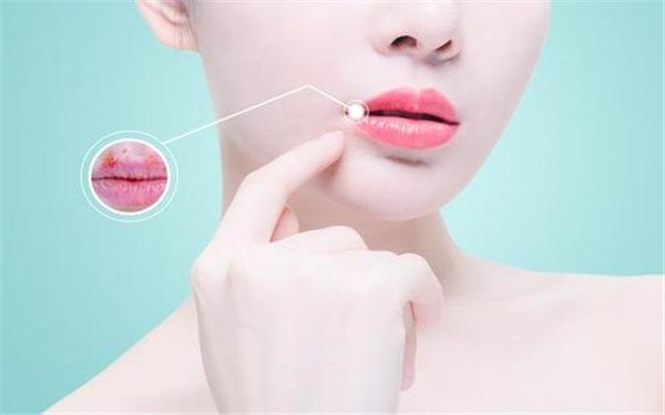 2023咸陽超皮秒祛印第安紋專家排行榜前10(史娟娟、姚平、蘭瑜技術(shù)專業(yè)審美在線)