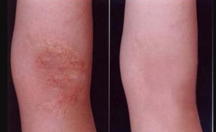 重慶整形醫(yī)院哪家效果好？權(quán)威排行榜來告訴你！