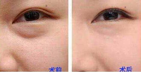 杭州整形美容界大咖PK，曾海峰、河?xùn)|鎬、高俊明，想知道磨骨哪個(gè)醫(yī)生靠譜？