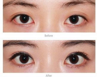 武漢處女膜修復(fù)哪家好？專業(yè)修復(fù)機構(gòu)推薦詳細(xì)比較