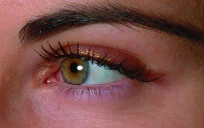 上海哪家醫(yī)院治療疤痕效果好？上海三甲疤痕醫(yī)院哪家最受歡迎？