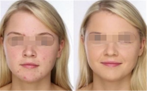 東莞哪家醫(yī)院做眼袋好？排名第一的權(quán)威醫(yī)院推薦