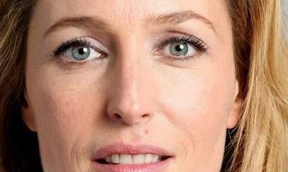 北京協(xié)和醫(yī)院整形科的拉皮效果好嗎？