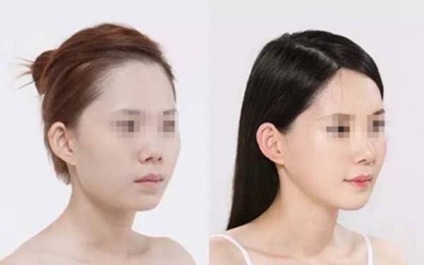 北京隆胸醫(yī)生排行：網(wǎng)友推薦的實(shí)力派、口碑出眾的美容專家值得關(guān)注