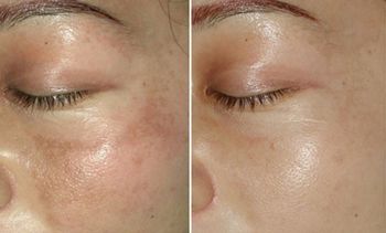 哈醫(yī)大二院整形科怎么樣？哈醫(yī)大二院整形科簡介|醫(yī)生團(tuán)隊|口碑評價！