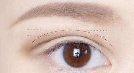 杭州劉軍鼻子塑形效果如何？個人簡介、醫(yī)院、費用詳情先給您解答