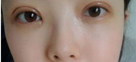 重慶隆鼻整形排名前三的醫(yī)院有哪些？