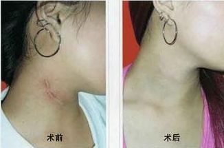 南寧哪家醫(yī)院治痘效果好？選擇明星們的美肌秘密推薦的南寧優(yōu)質(zhì)醫(yī)院