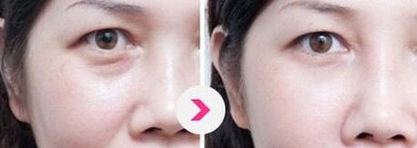 北京哪位醫(yī)生擅長(zhǎng)巨乳縮小手術(shù)？5名實(shí)力醫(yī)生值得推薦