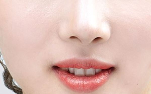 東莞市人民醫(yī)院劉玉生面部整形術(shù)效果如何？