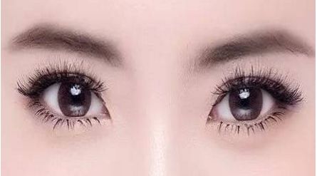 南寧自體填充淚溝哪家好？探索最佳南寧自體填充淚溝選擇