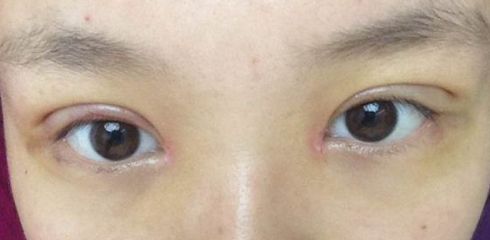 徐州做拉皮哪家醫(yī)院好？一起來看看徐州市最受歡迎的做拉皮醫(yī)院