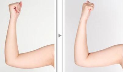 經(jīng)歷了八大處滕利，我的下顎骨煥然一新！附美女下頜角磨骨完美蛻變，婚禮前就要變美！