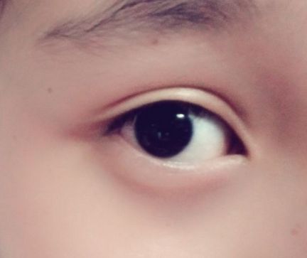 上饒祛眼袋哪家醫(yī)院好？解析上饒地區(qū)的眼袋整形醫(yī)院排名及選擇標(biāo)準