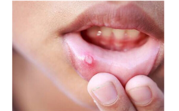 2023潮州水滴型假體隆胸正規(guī)醫(yī)生排行榜十強(鄭敏、郭建濱、林桂松解鎖前三強)