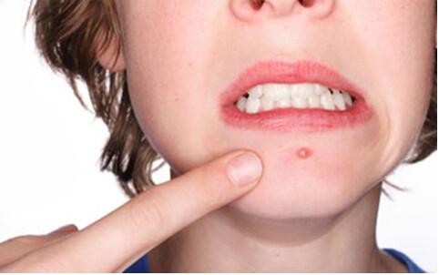 華中地區(qū)整形美容醫(yī)院張婷醫(yī)師的胎記祛除技巧跨越行業(yè)高度，備受贊譽！