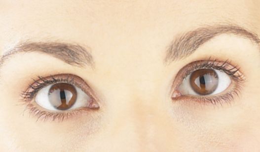 南寧哪家祛痘的醫(yī)院好？找到最適合您的祛痘專家！