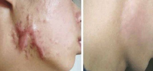 海口市整形醫(yī)院哪家好？專家推薦最具口碑的海口整形醫(yī)院有哪些？